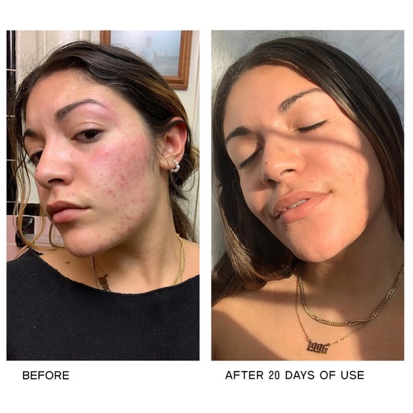 SOBEL SKIN Rx - 4.5% Retinol Serum - Picture 3 of 5